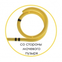 Мочеточниковый стент c покрытием Urotech Yellow Star