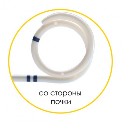 Мочеточниковый стент Urotech White Star
