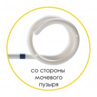 Мочеточниковый стент Urotech White Star