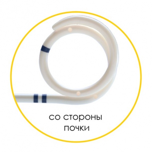 Мочеточниковый стент Urotech White Star